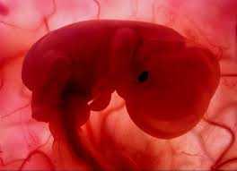 aborto