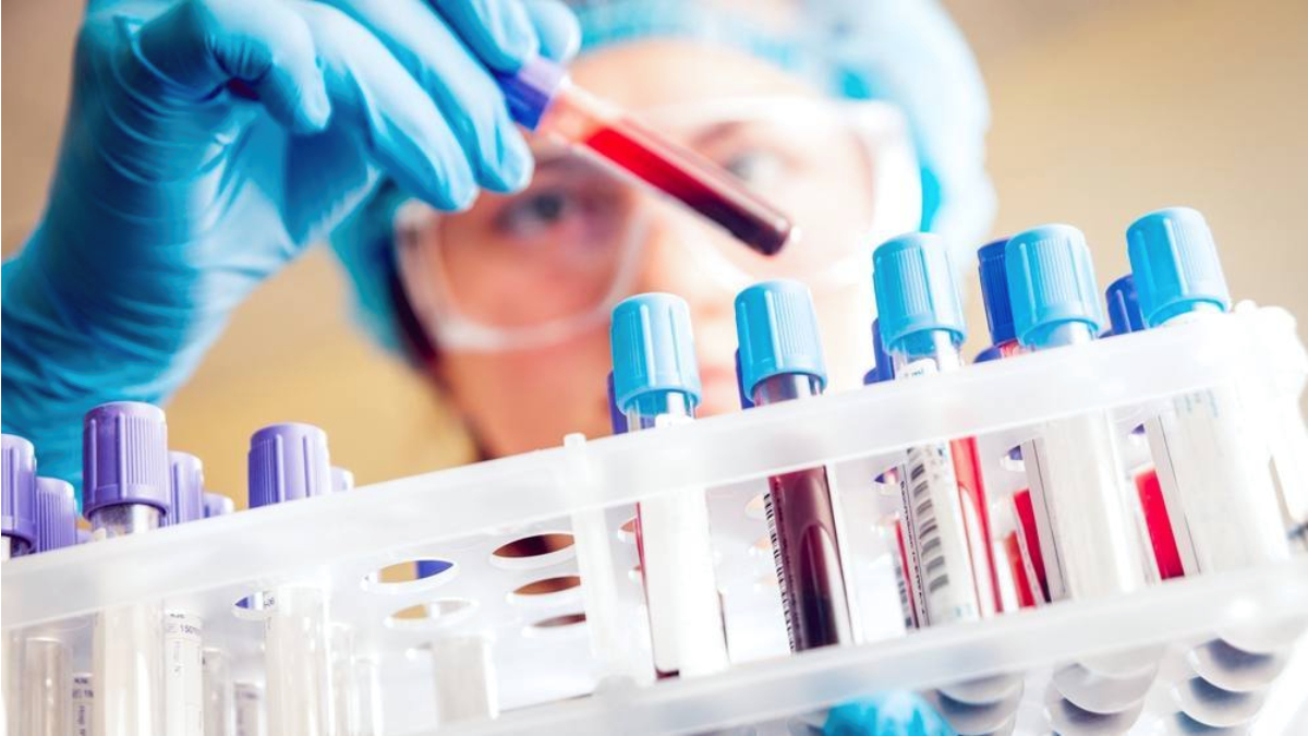 Análisis de sangre muestra potencial para detectar cáncer testicular cuando los marcadores estándar no lo detectan